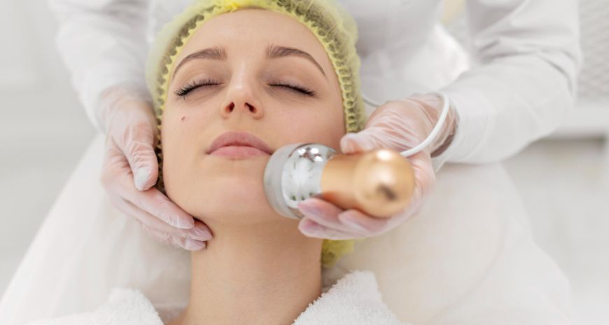 Acne Treatment In Dubai