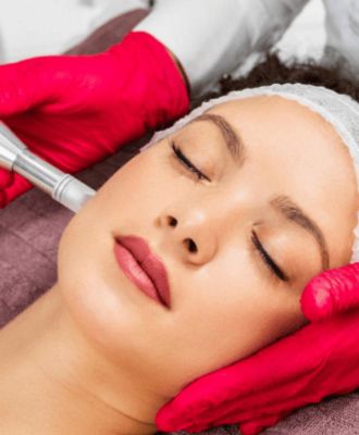 Full Face Contouring with Filler