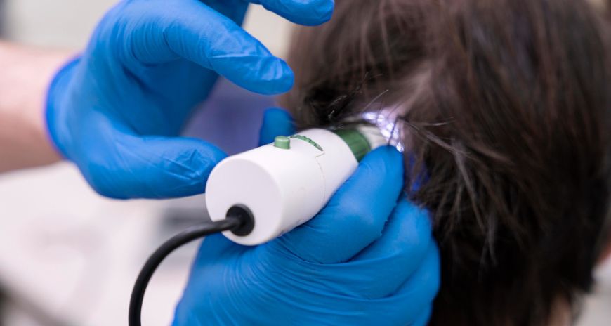 Laser for Hair Growth in Dubai