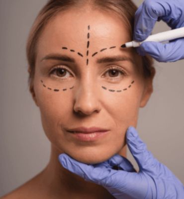 Thread lift in Dubai