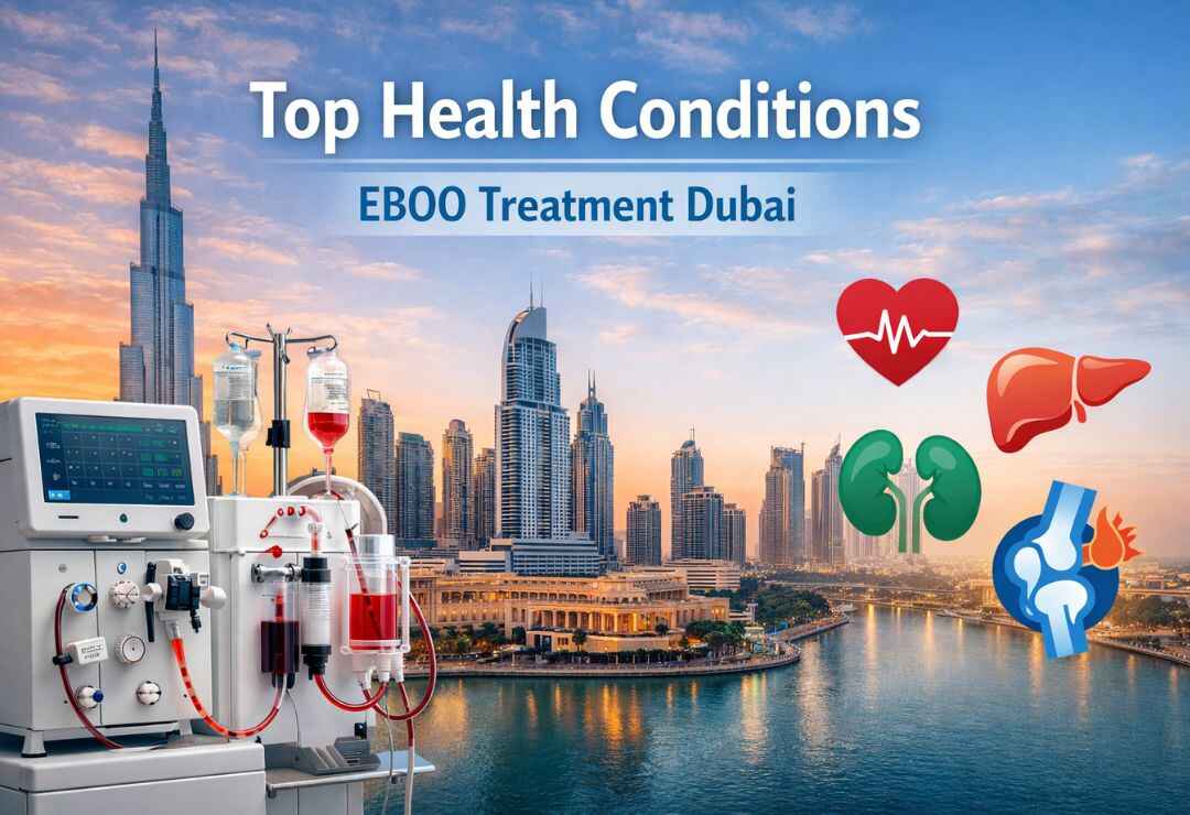 EBOO Treatment Dubai