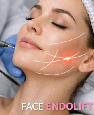 Face Endolift
