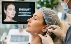 Face Endolift in Dubai