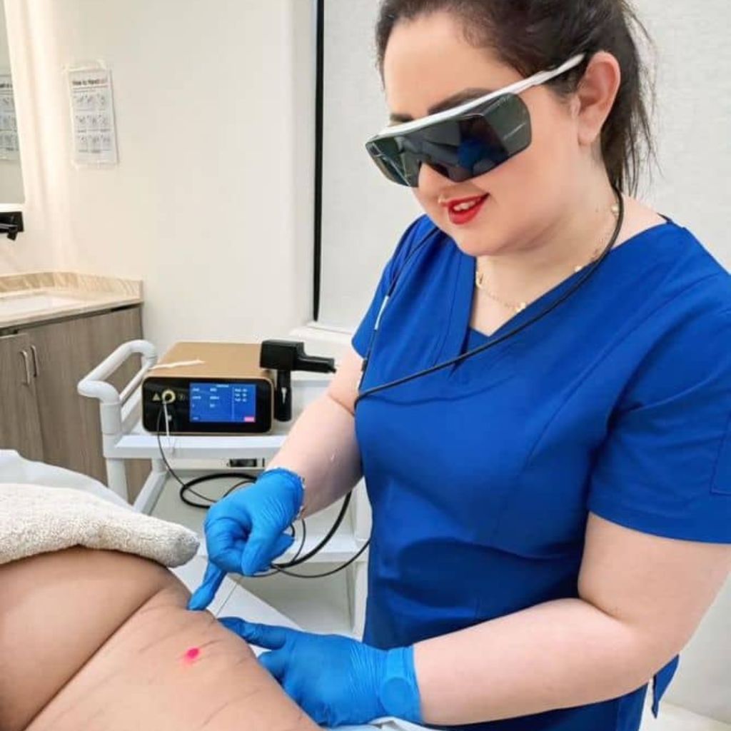 Endolift For Thigh