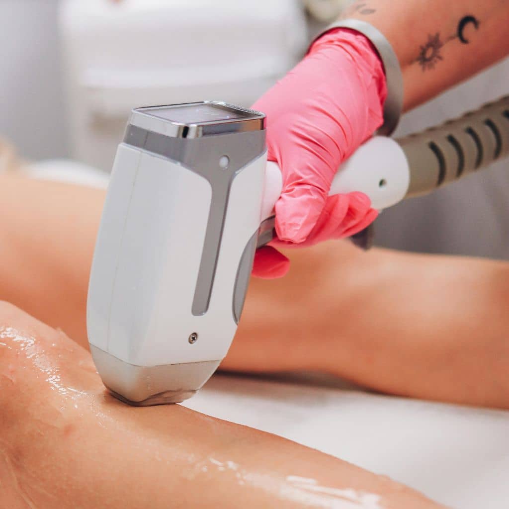 Laser Hair Removal Treatment In Dubai
