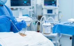 Post-Liposuction Irregularities