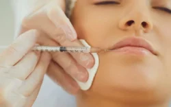 Natural Lip Fillers in Dubai