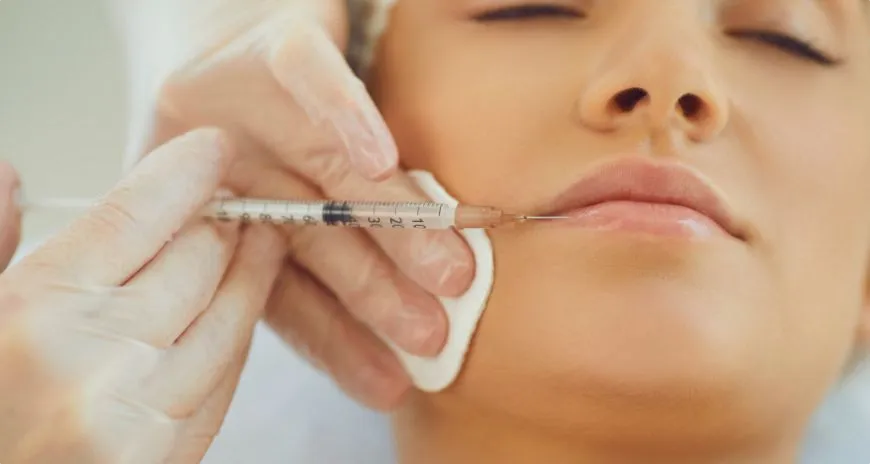 Natural Lip Fillers in Dubai