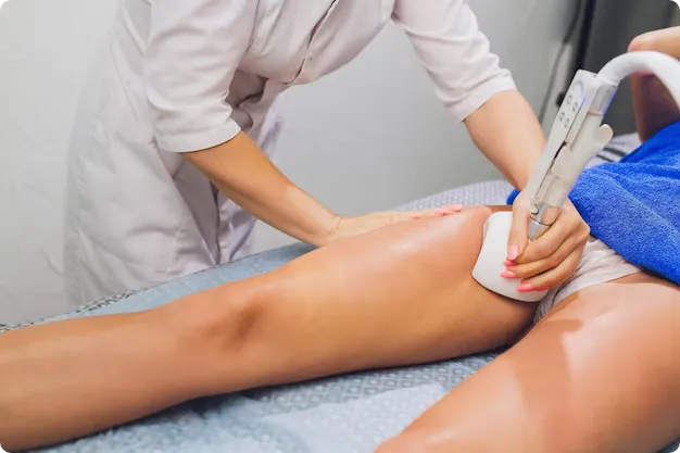 Endolift Leg Treatment