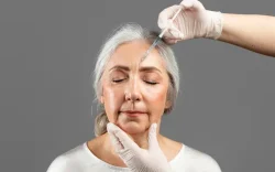 Endolift by Age