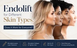 Endolift for skin types