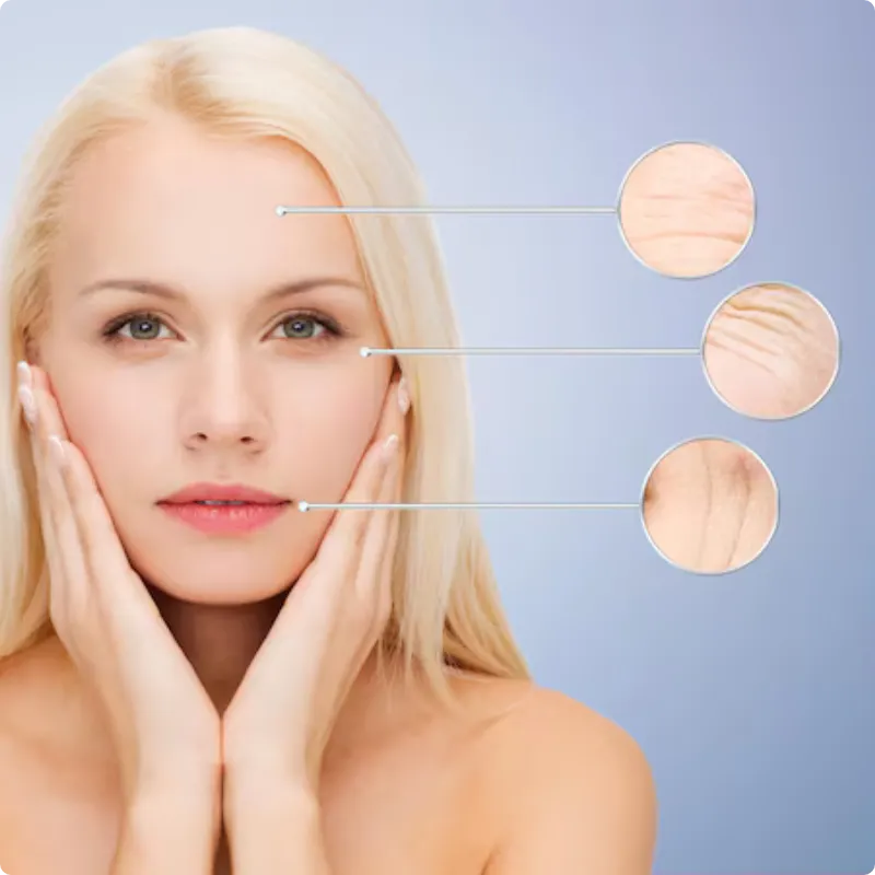 Endolift skin tightening