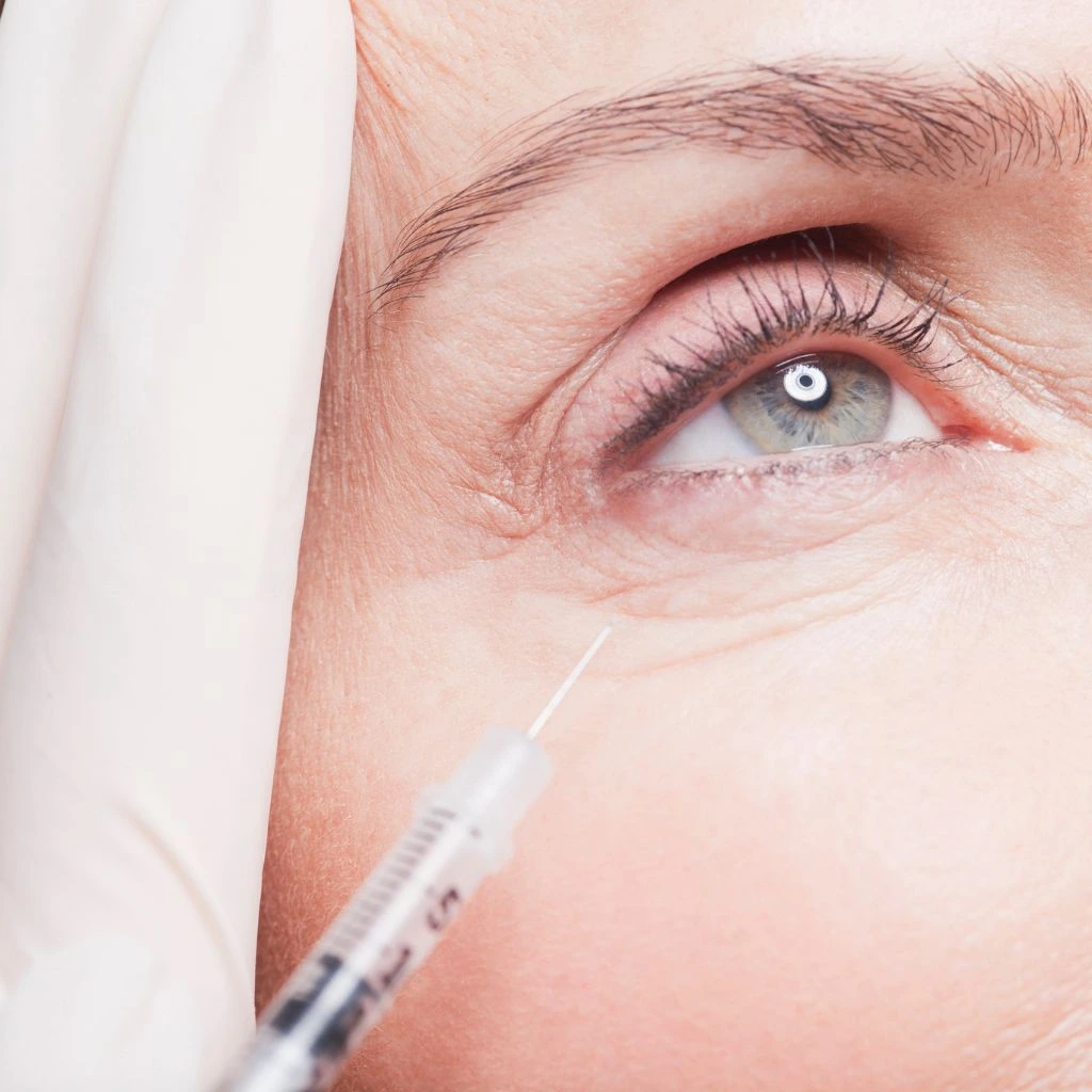 PRP Under Eyes