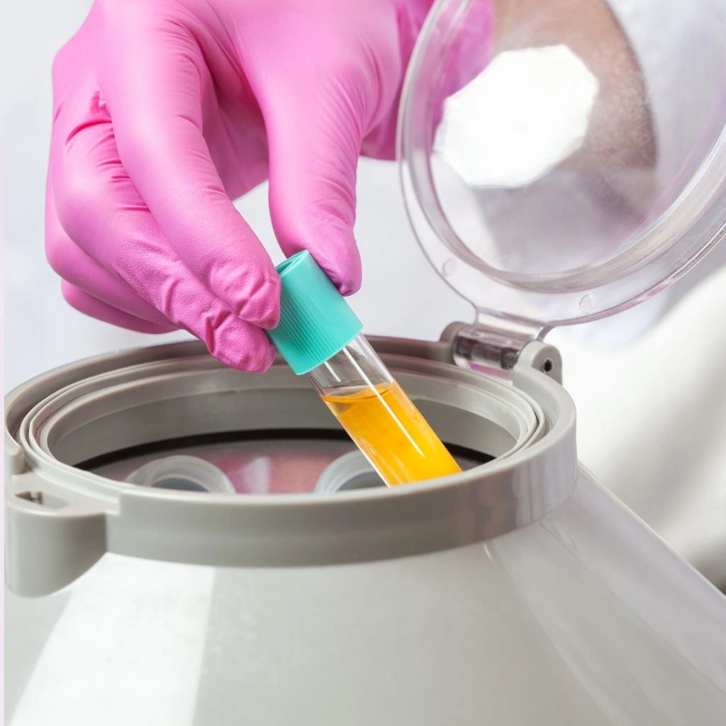 PRP face Injection