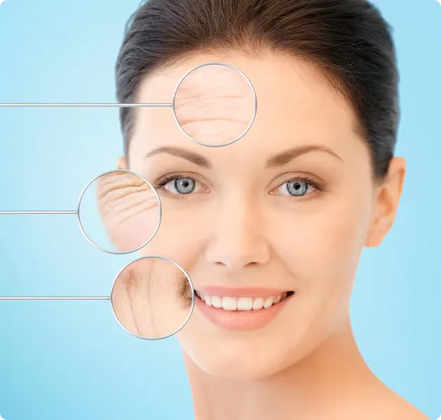 botox for skin