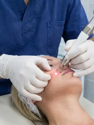 Face Endolift Treatment