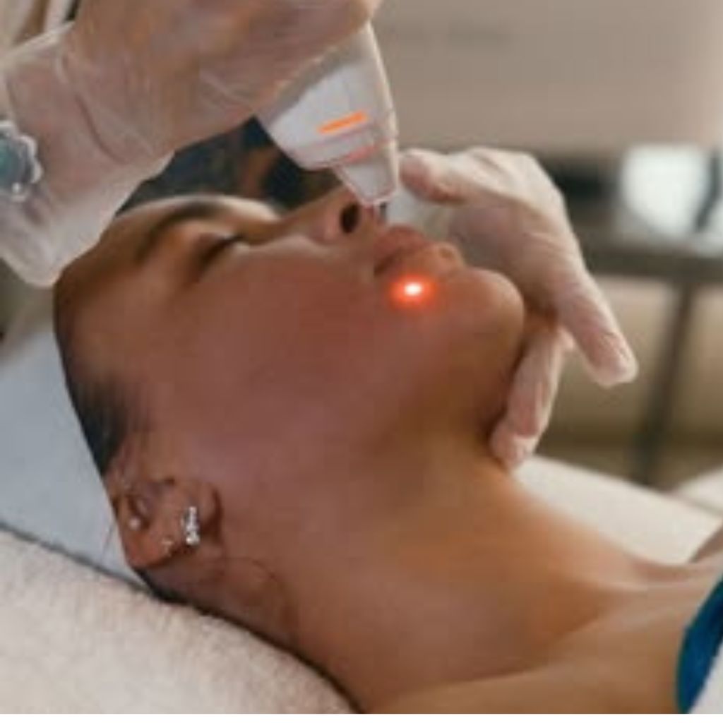 Face Endolift results Dubai