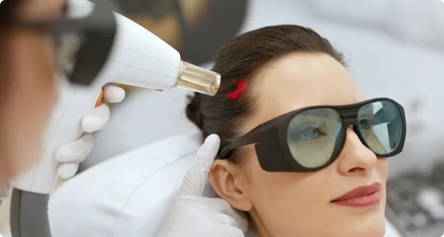 Laser Hair Growth Treatment