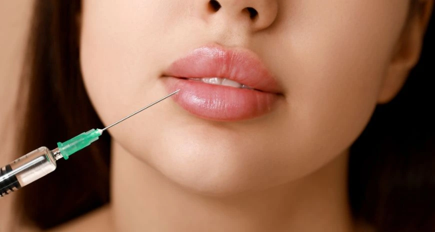 PRF Treatment for Lips