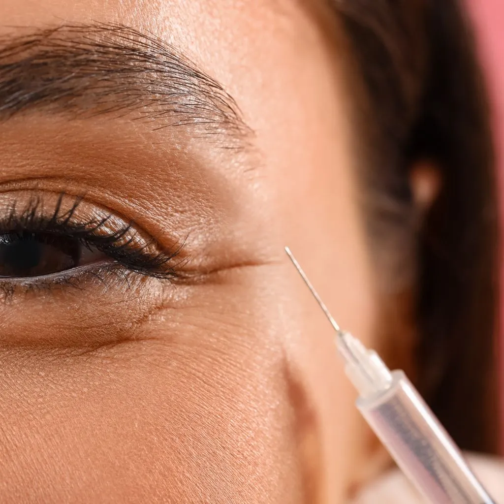 Under Eye Filler Treatment