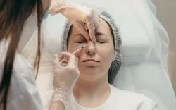 filler for wrinkles