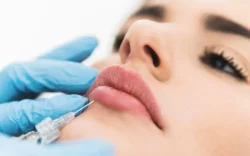 lip filler techniques