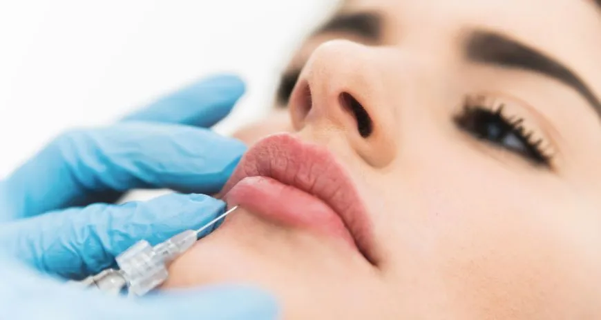 lip filler techniques