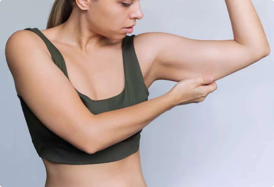 Loose Arm Skin After Weight Loss