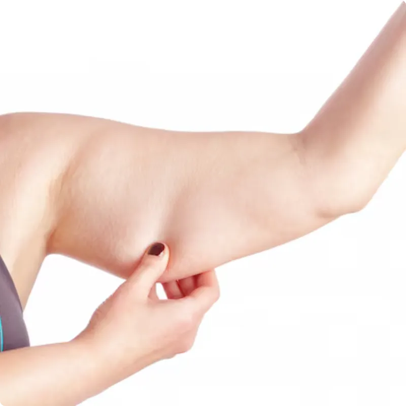 saggy arms after weight loss