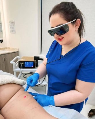 Endolift for Thigh